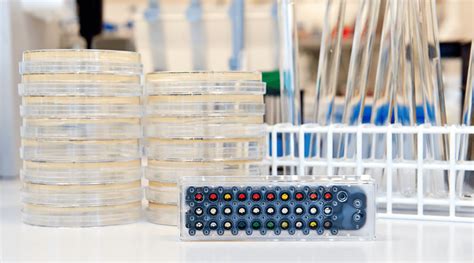 Bacterial Endotoxin Testing (BET): Comprehensive Overview For .